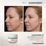 Cosmelan Peel Certificate Course (Online Zoom Training Course)