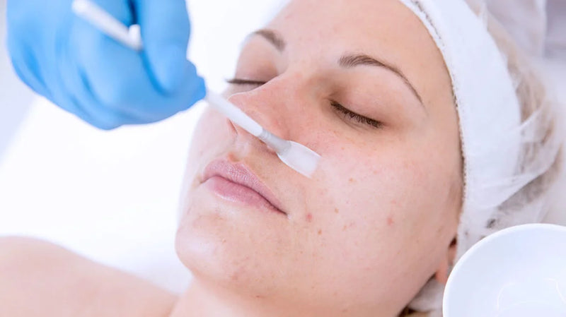 Chemical Peels Certificate Course (Online Zoom Training Course)