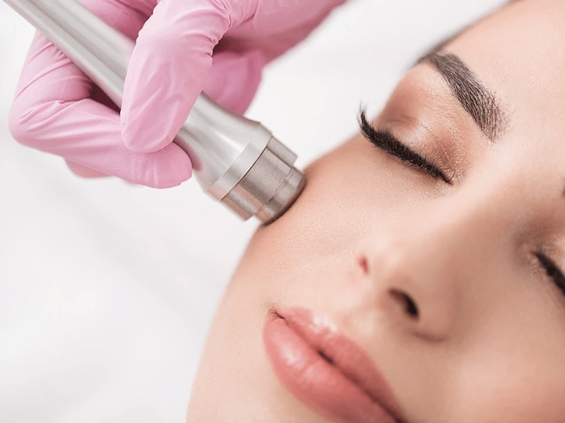 Microdermabrasion Certificate Course (Online Zoom Training)