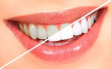 Teeth Whitening Certificate Course