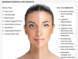 Chemical Peels Diploma (Board Certified)